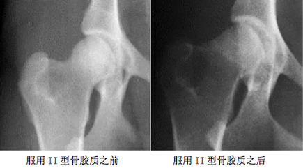 商业信息： 警钟长鸣！糖尿病并发症、血糖标准